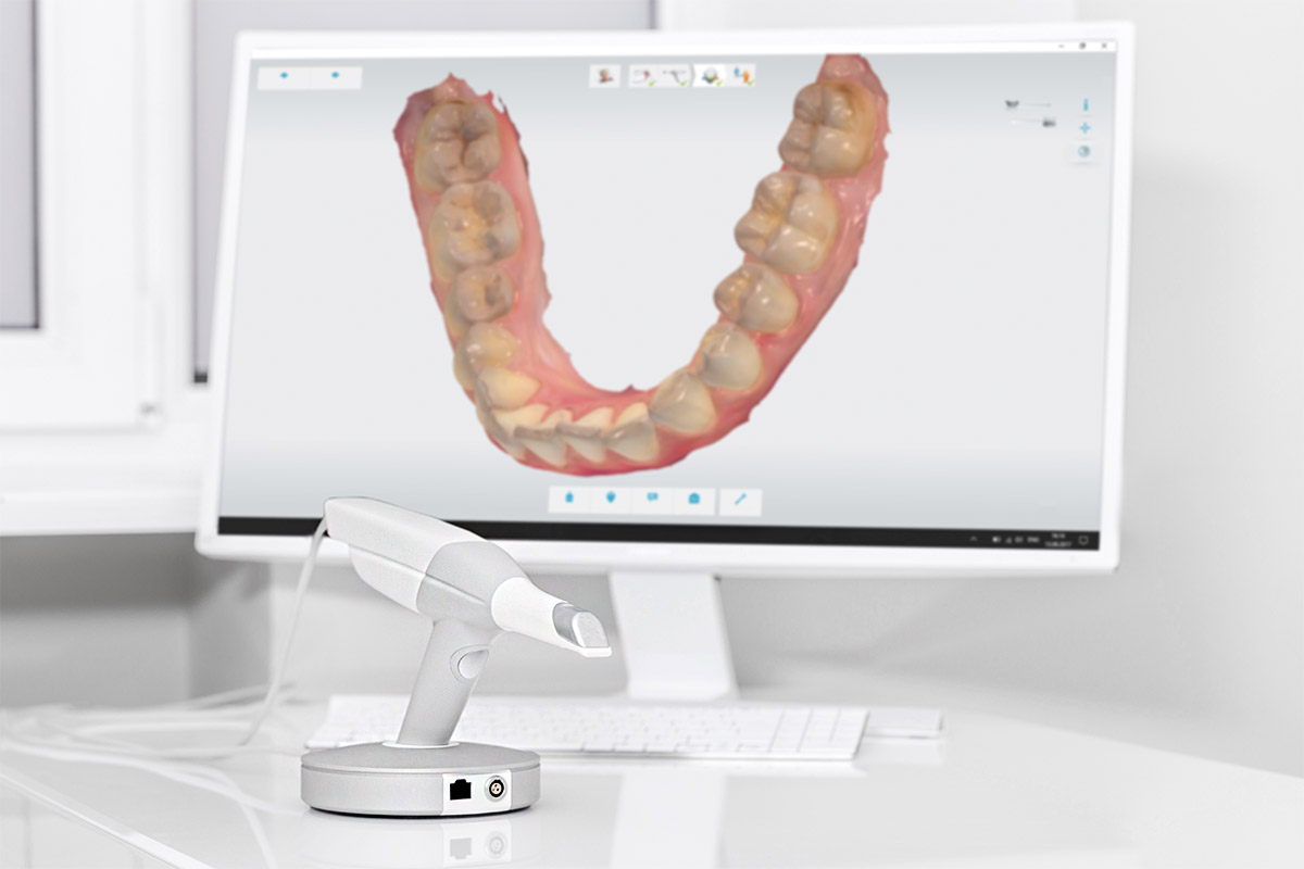 Escáner intraoral 3Shape TRIOS 3